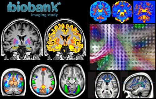 Resting State fMRI: From Basic Concepts to Advance Applications in the UK BioBank