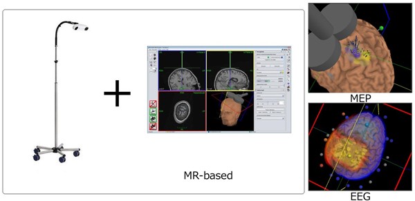 Figure 5: Navigation camera and MEP and EEG projection on the brain in Navigation system 