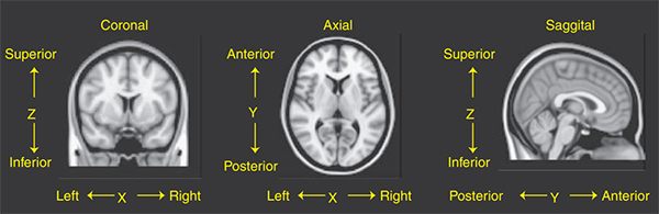 نمایش 3 محور اصلی در صفحه مختصات استاندارد برای تصویر MRI