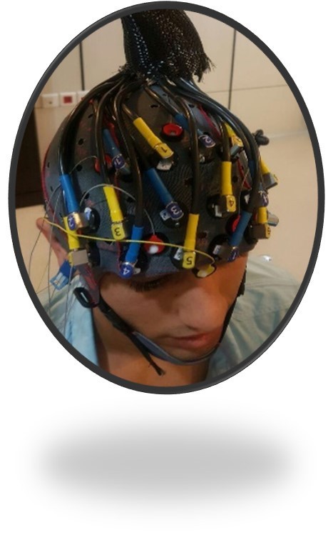 ثبت همزمان fNIRS-EEG