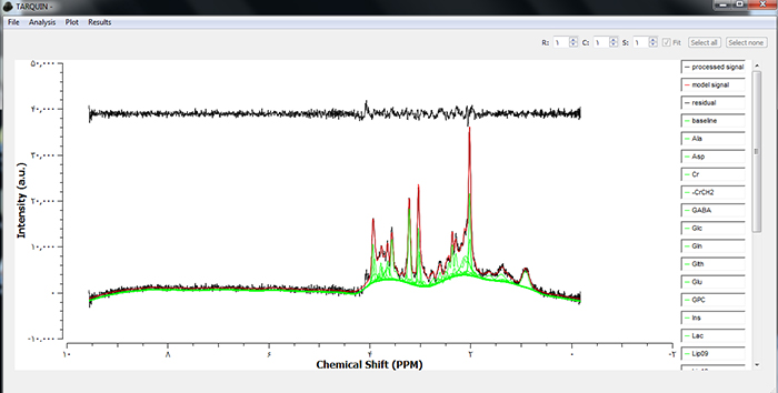  An example of MRS data Analysis using TARQUIN MATLAB Toolbox