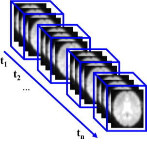 شکل 1. داده 4 بعدی fMRI که شامل تصاویر 3 بعدی از مغز در طول زمان می شود.