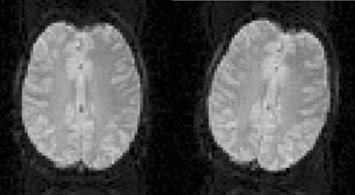 نمونه ای از تصاویر fMRI در دو زمان متفاوت