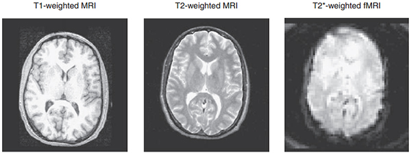 نمونه هایی از تصاویر مختلف MRI