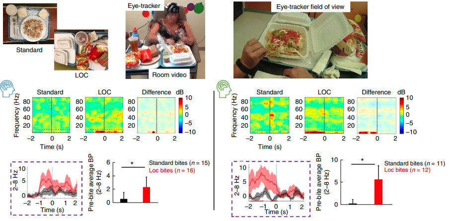 Pilot study of responsive nucleus accumbens deep brain stimulation for loss-of-control eating