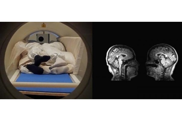 Couples MRI Investigates How Touching is Perceived in the Brain