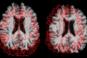پردازش تصاویر fMRI - قسمت بیست و یکم