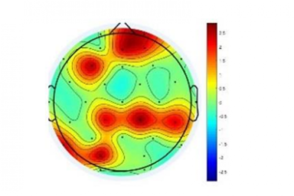 تحلیل مبتنی بر فرکتال تأثیر تغییرات الگوهای ریتمیک موسیقی بر مغز انسان