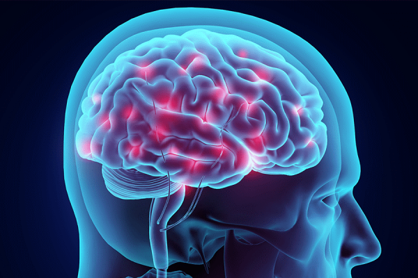 Brain network activity can improve in epilepsy patients after surgery