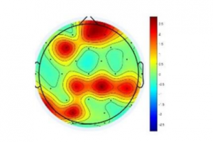 تحلیل مبتنی بر فرکتال تأثیر تغییرات الگوهای ریتمیک موسیقی بر مغز انسان