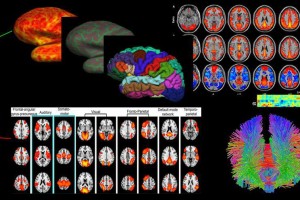 خدمات نوین پردازش تصویر در آزمایشگاه ملی نقشه برداری مغز