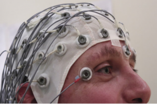 A.I. algorithms study brain waves to predict seizures