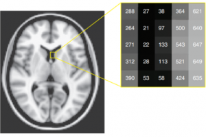 پردازش تصاویر fMRI - قسمت یازدهم
