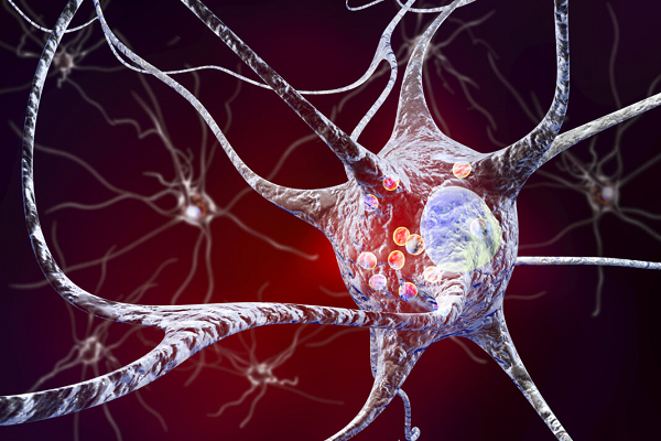 پروتئین NEMO می‌تواند توده‌های پروتئینی موجود در مغز بیماران پارکینسون را از بین ببرد