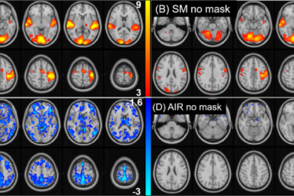 آیا استفاده از ماسک در پاندمی کووید19 بر فعالیت شناختی مغز تأثیر می گذارد؟