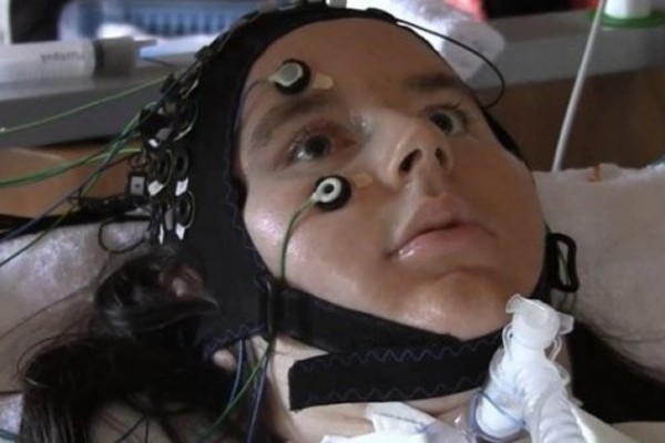   دستگاه قابل پوشیدن fNIRS به بیماران مبتلا به ALS که «قفل شده اند» اجازه می دهد با هم ارتباط برقرار کنند.