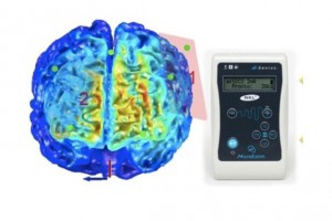 Transcranial Stimulation Enhances Beneficial Effect of Aerobic Exercise on Gait in Parkinson’s Patients