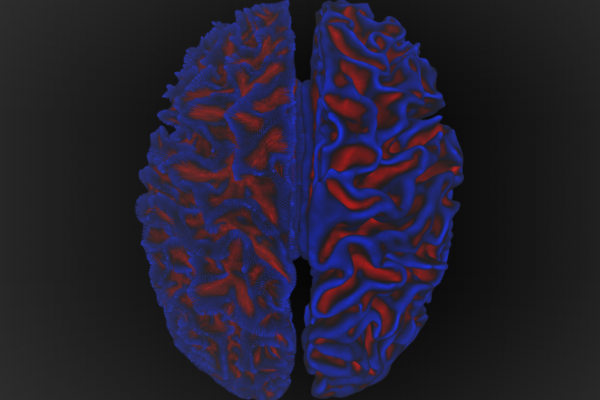 نقشه برداری از شبکه‌های مغزی، توزیع کاهش ضخامت کورتکس را در مغز روشن می‌کند