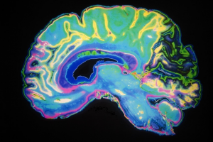 اسکنر پوشیدنی مغز ؛ تصویربرداری از مغز حین حرکت