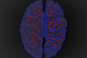 نقشه برداری از شبکه‌های مغزی، توزیع کاهش ضخامت کورتکس را در مغز روشن می‌کند