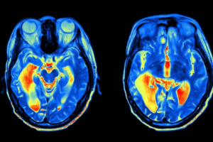 اسکن‌های ام‌.آر.آی نشان می‌دهند که احساس جوانی کردن می‌تواند نشانی از سلامت مغز باشد.