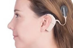Brain Responses to Lip-Reading Can Benefit Cochlear Implant Users