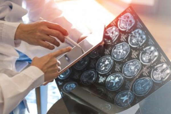 Brain imaging alternative to functional MRI may ‘change neuroimaging forever’