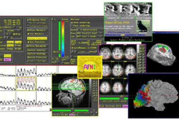 پردازش تصاویر fMRI - قسمت ششم