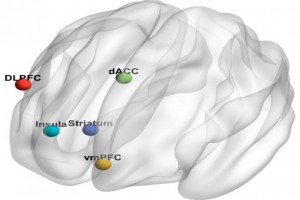Using functional connectivity changes associated with cognitive fatigue to delineate a fatigue network