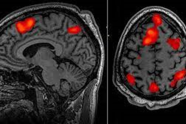 علوم اعصاب: خطرات خواندن مغز