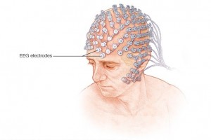 Using EEG data to diagnose Parkinson's disease