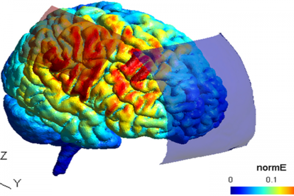 تحریک مغناطیسی مغز منجر به بهبود یادگیری مهارت حرکتی جدید در سالمندان می شود