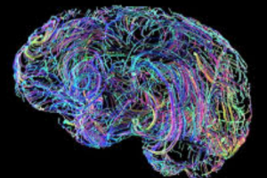 چالش نوآوری با حمایت ستاد توسعه علوم شناختی : طراحی و ساخت یک سیستم تحریک غیرتهاجمی نواحی عمیق مغز