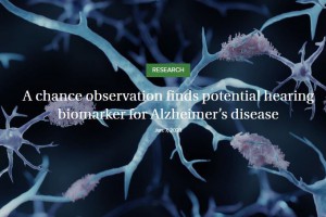 A Chance Observation Finds Potential Hearing Biomarker for Alzheimer’s Disease