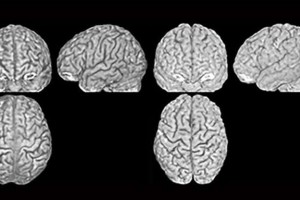 هر فردی آناتومی مغز منحصر به فرد دارد.