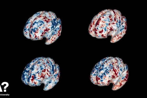 اسکنهای مغزی نشان میدهند که چگونه سرنخ‌ها را حل میکنیم