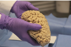 ذخیره‌سازی ۱۲۰ مغز انسان در بانک مغز ایران