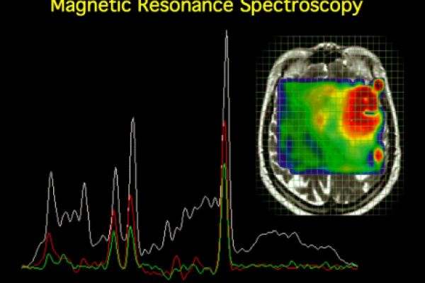 The new service in the NBML’s image processing laboratory: Analysis of MR Spectroscopy