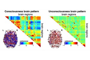 Imaging of the human brain reveals constellations of activity associated with conscious and unconscious states