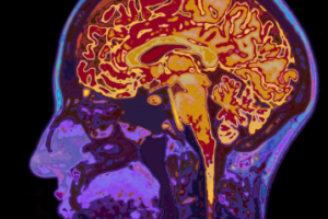 تصویربرداری مولکولی جدید، مؤثر در کمک به مقابله با اختلالات مغزی