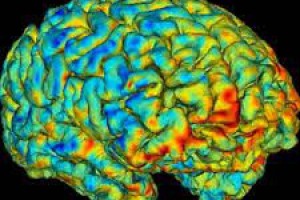 استفاده از نشانگرهای زیستی MRI در جهت افزایش دقت تجویز داروهای ضد افسردگی