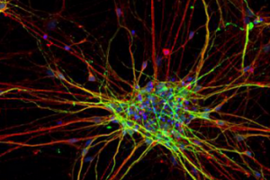 Neurons Develop Differently in Autism