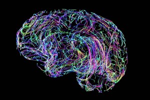 ارتباطات عصبی ضعیف بین دو ناحیه از مغز، ممکن است بتواند خطر ابتلا به آلزایمر را پیش بینی کند