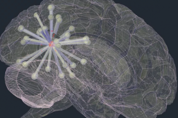 How Alzheimer’s disease spreads throughout the brain 