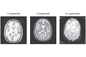 پردازش تصاویر fMRI - قسمت بیست و چهارم