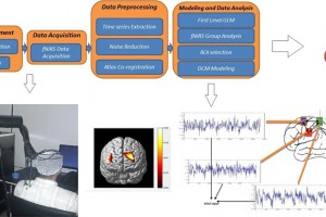 Identification of the Pain Process by Cold Stimulation: Using Dynamic Causal Modeling of Effective Connectivity in Functional Near-Infrared Spectroscopy (fNIRS)