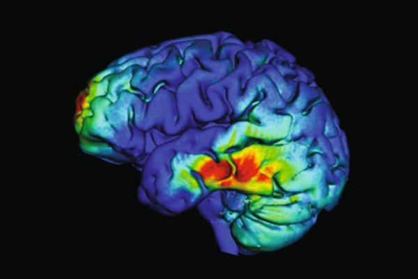 موج‌های هماهنگ در مغز افراد مسن حافظه را تقویت می‌کنند