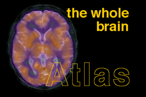 The Whole Brain Atlas