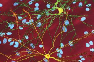 رشد سلول‌های پشتیبان مغزی در بیماری‌ هانتینگتون دچار نقص می‌شود