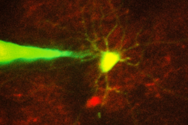 Robotic system monitors specific neurons